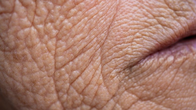 Deep Wrinkles