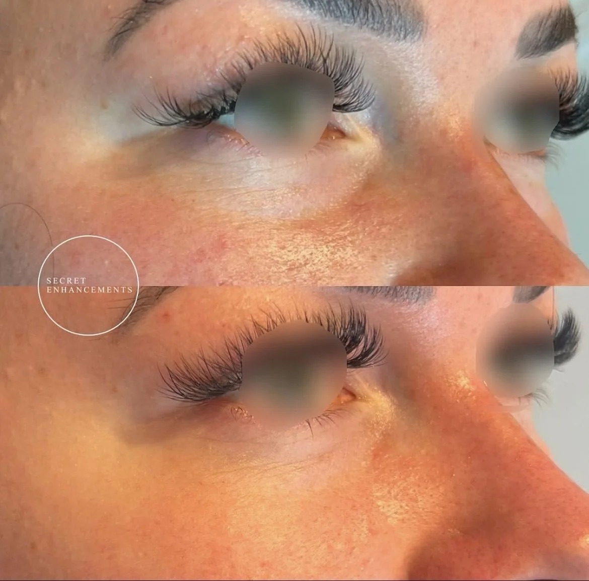 What Are Polynucleotides? The Skin Regeneration Treatment Explained by Our Milton Keynes Clinic