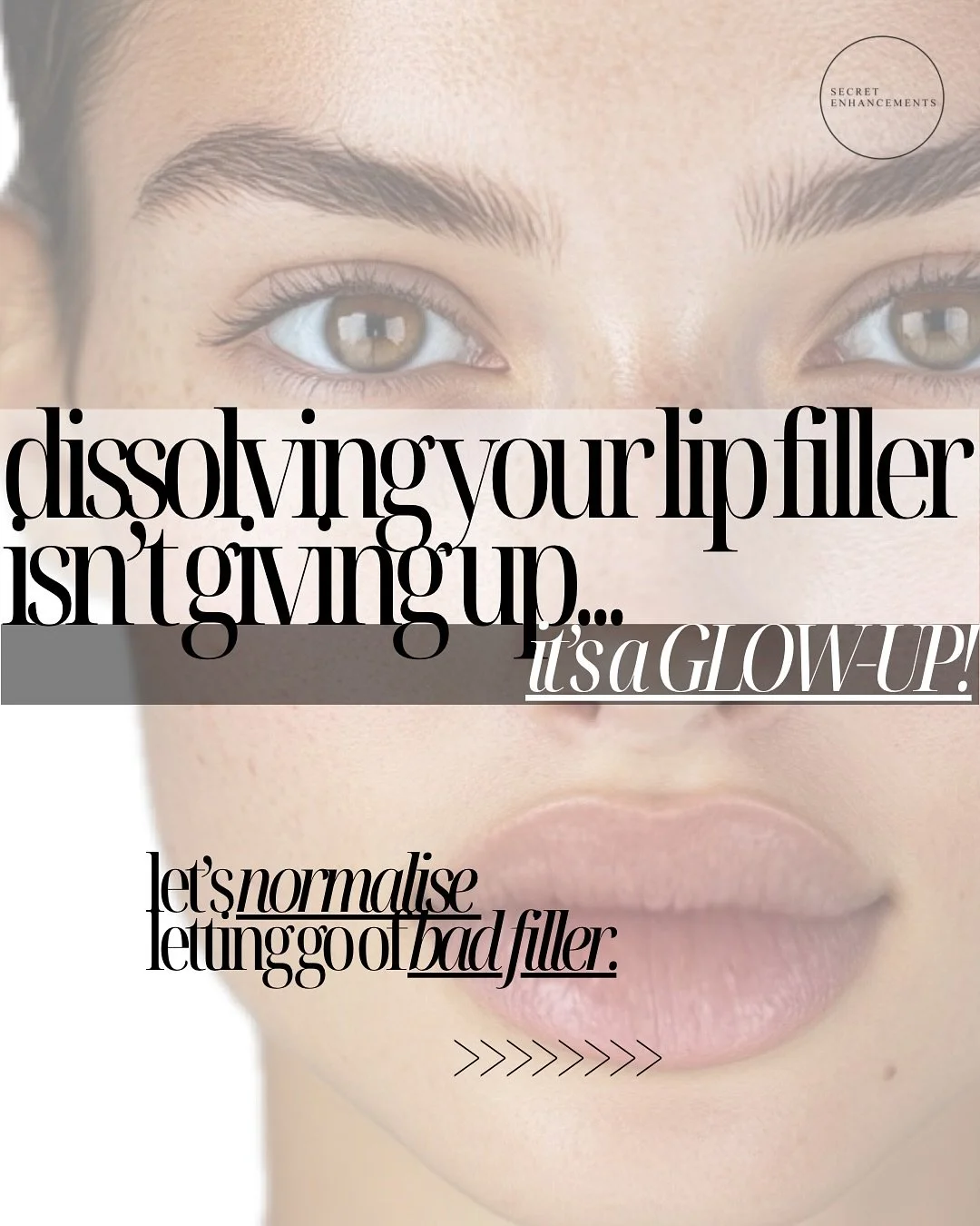 Is it time to dissolve your filler? 🪄🪄🪄🪄