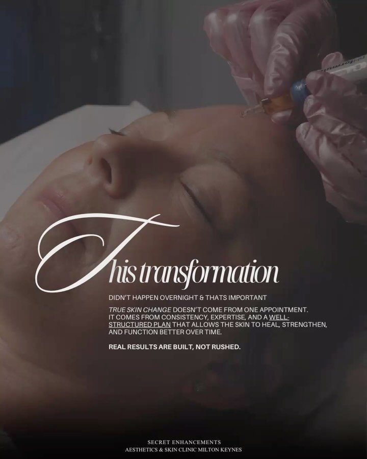 8-Week Age Management Skin Transformation ✨

At Secret Enhancements, Milton Keynes, our bespoke 8-week age management programme combines the precision of pHformula medical-grade skincare with advanced resurfacing treatments to reveal smoother, bright