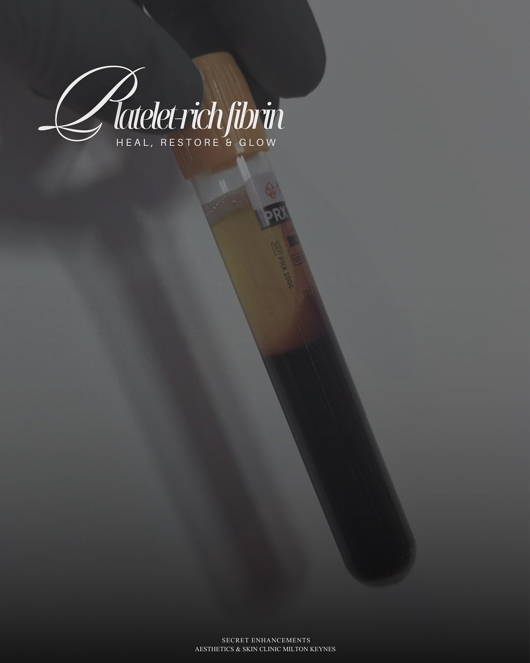 iPRF. Regenerative Skin Rejuvenation ✨

At Secret Enhancements, Milton Keynes, iPRF (injectable Platelet-Rich Fibrin) is an advanced regenerative treatment that works with your body&rsquo;s own healing processes to restore skin quality from within.

