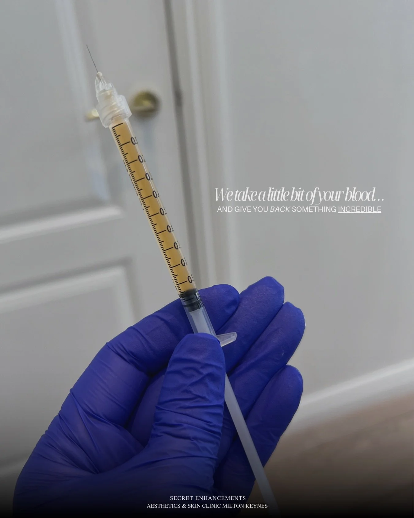 Your skin called, it wants iPRF&hellip; ☎️🩸

If you haven&rsquo;t heard of iPRF yet, let us introduce you to the treatment your skin has been quietly begging for.

Injectable Platelet-Rich Fibrin (iPRF) is nature&rsquo;s own skin rejuvenator, we tak