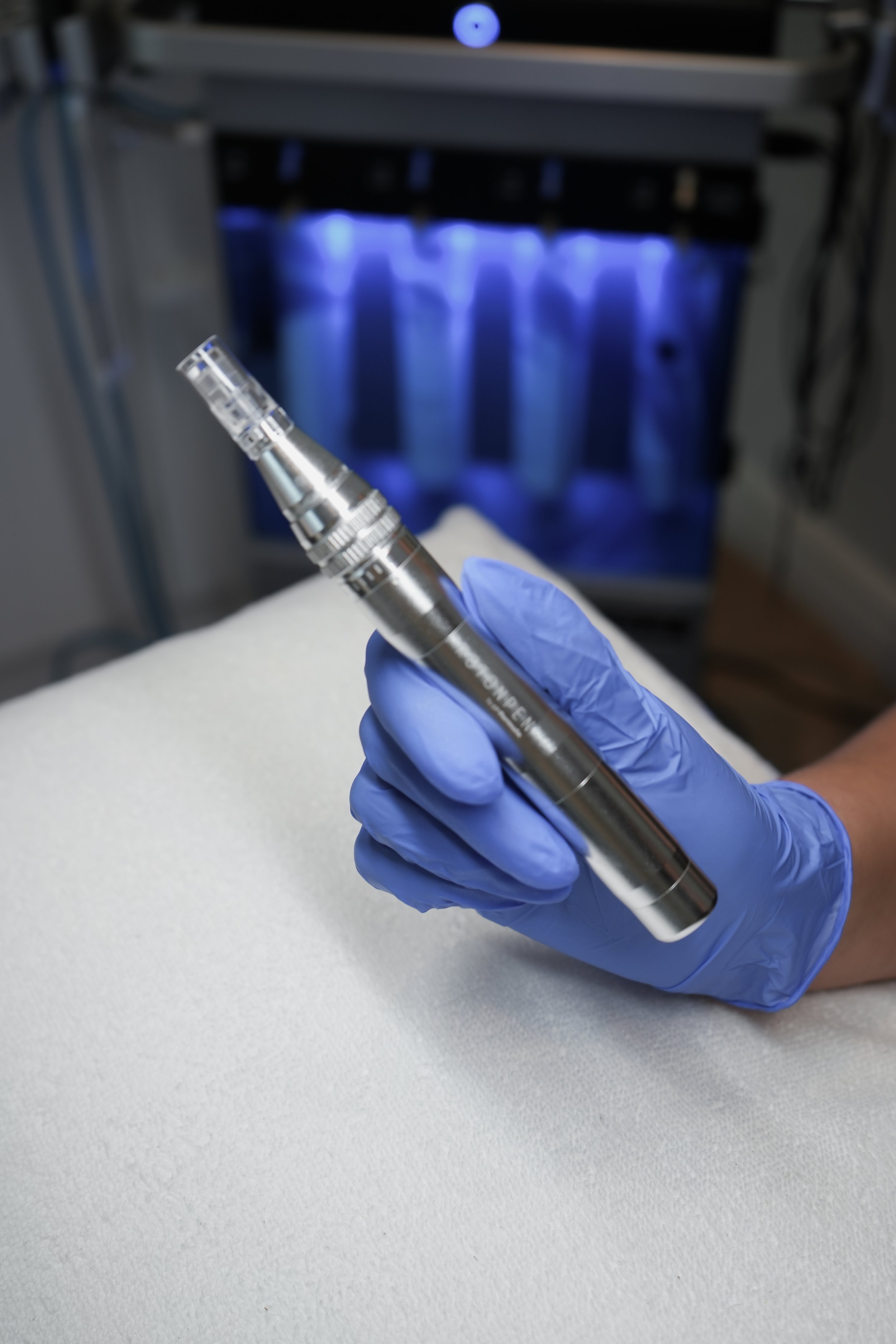 Is Microneedling Worth the Money? What Real Customers Say