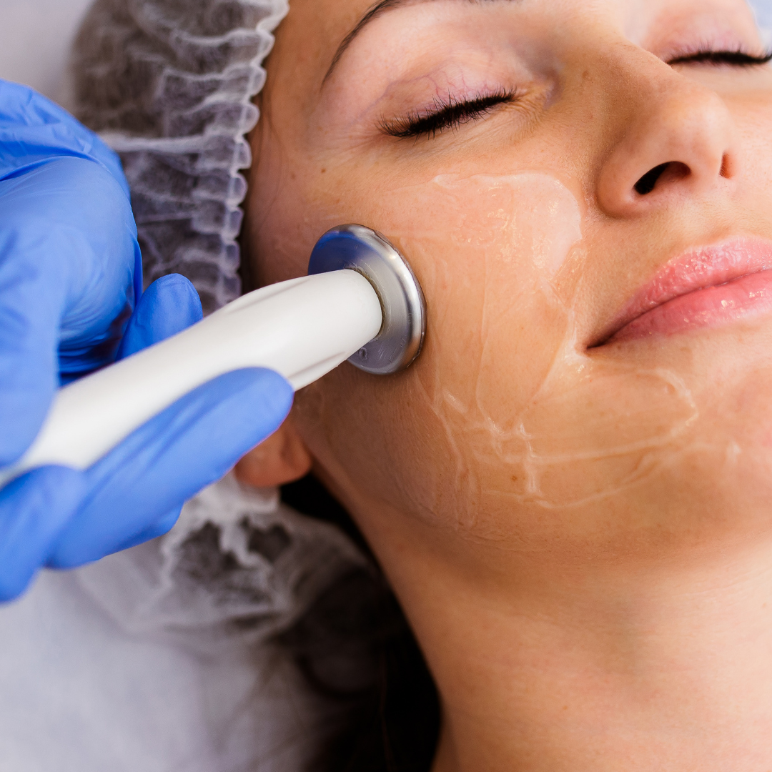 radiofrequency skin tightening Milton Keynes