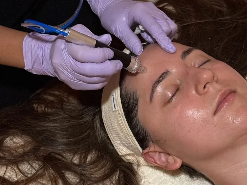 Rosacea/Sensitive Skin