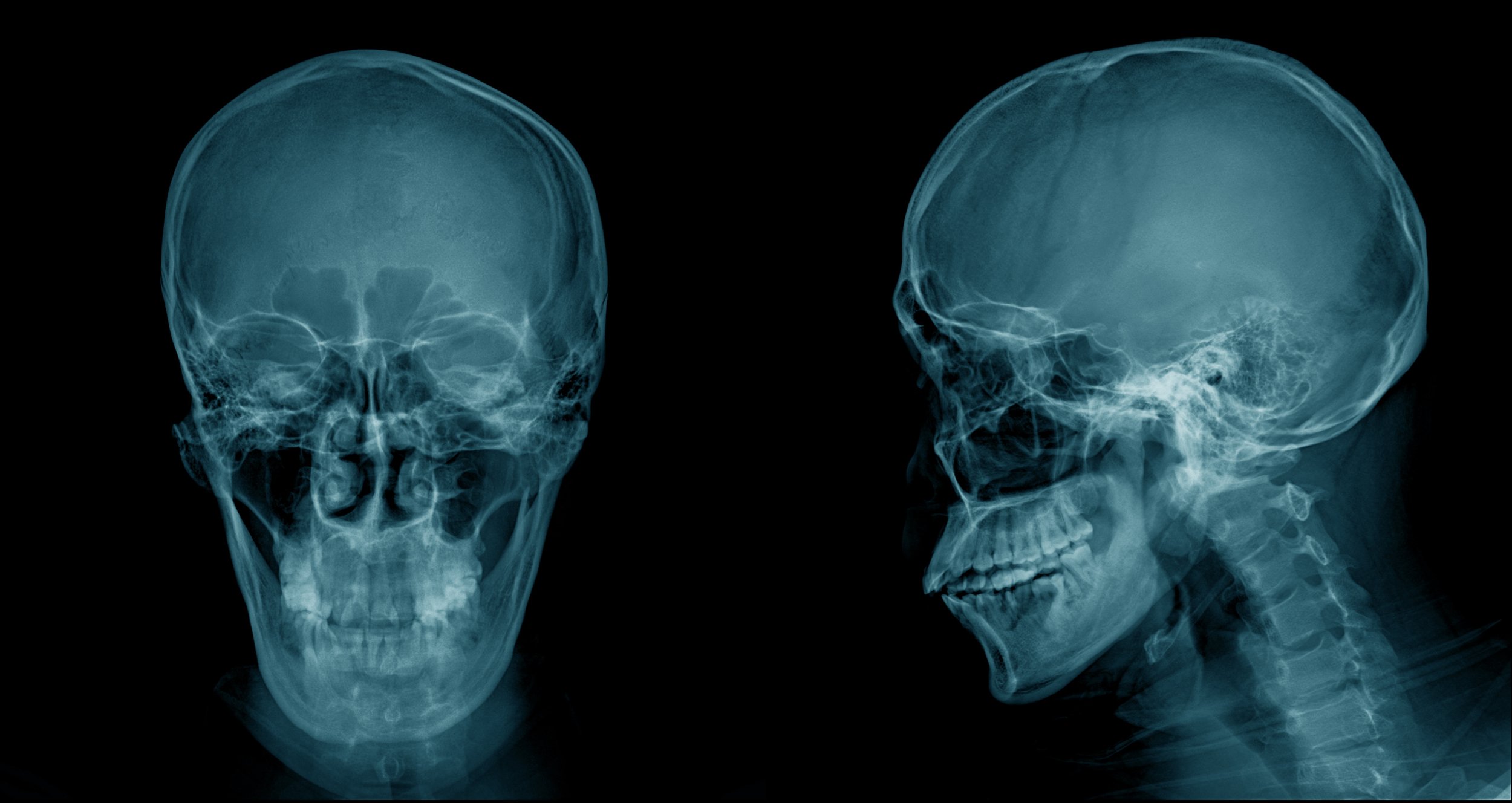 Head and Neck.jpeg