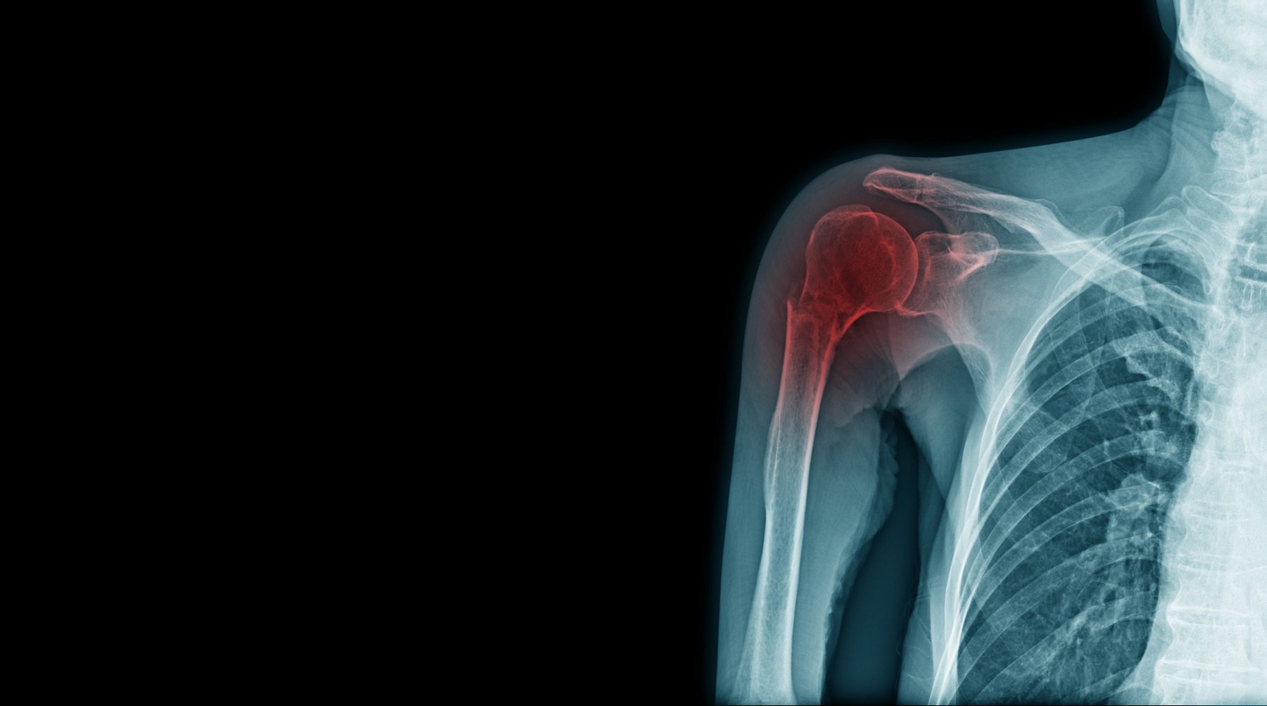 MSK Imaging: A Multimodality Approach to Small and Large Joint Pathology | 3-4 February 2027 | Virtual attendance / On-Demand