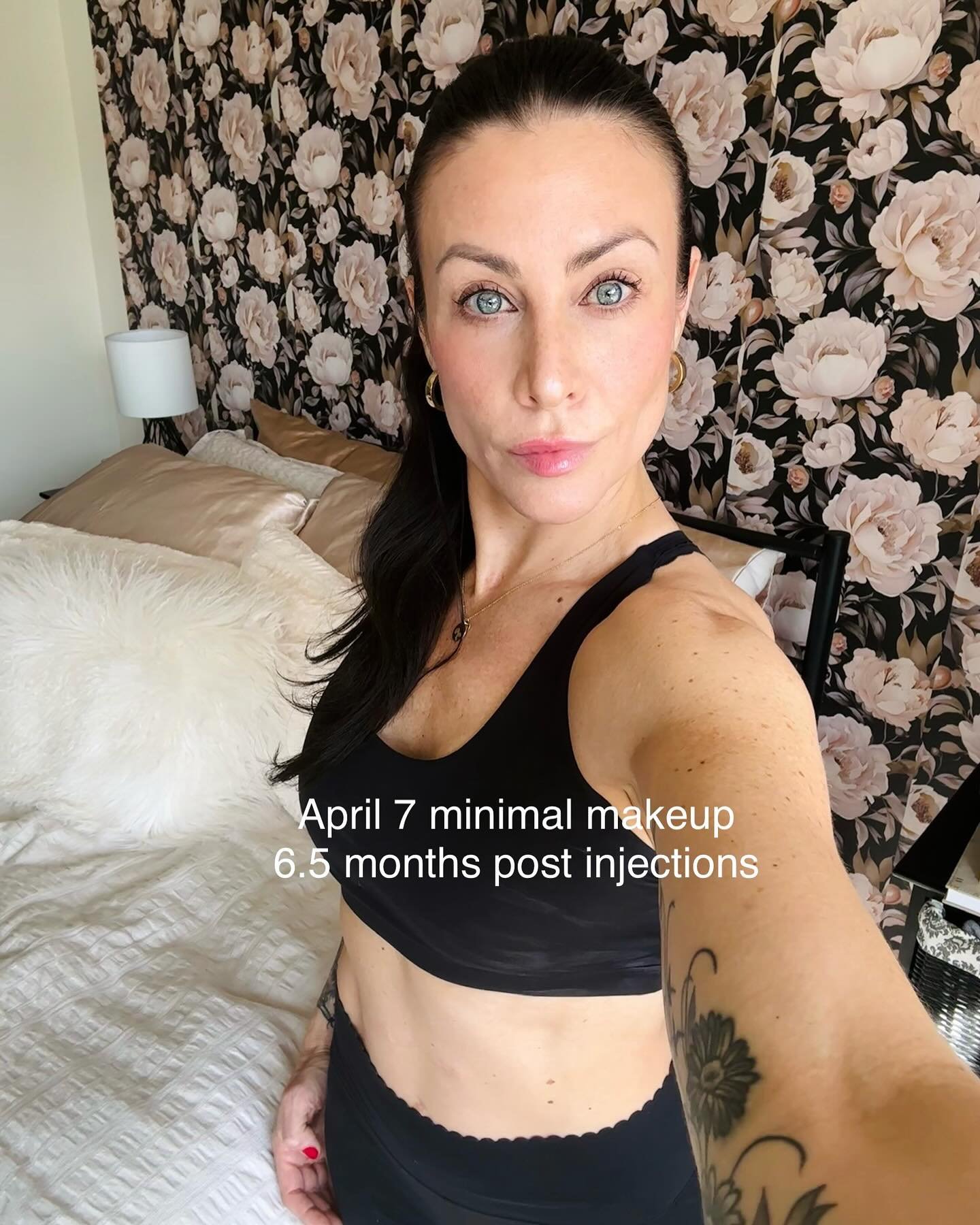 I want you to love yourself. Inside out. And I also want to be very transparent. 

In January I started using facial sculpture + cupping on myself, and in February I took the training for this as well as buccal massage. 

I last had injections in Sep