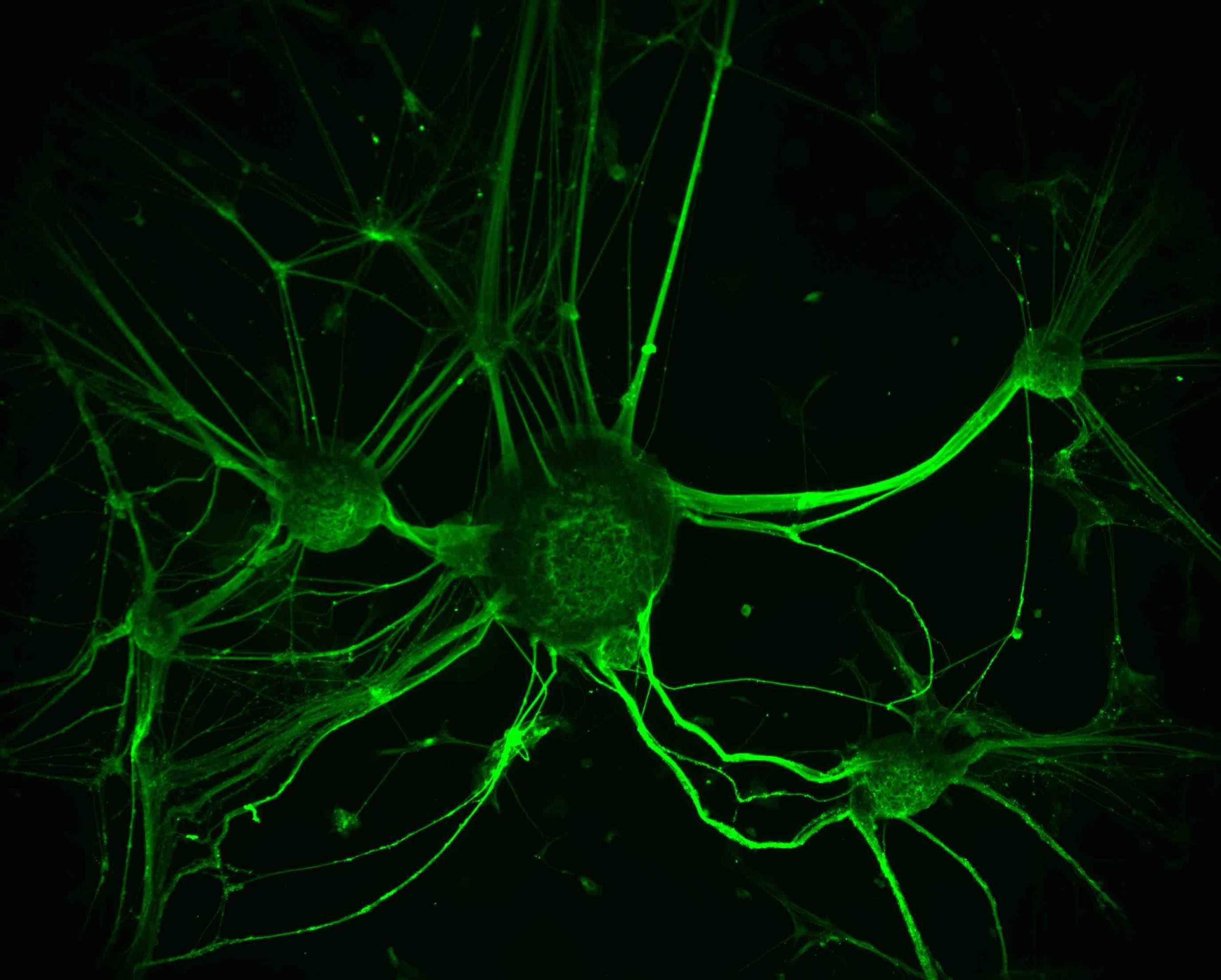 (D) SO Motor Neurons.jpg