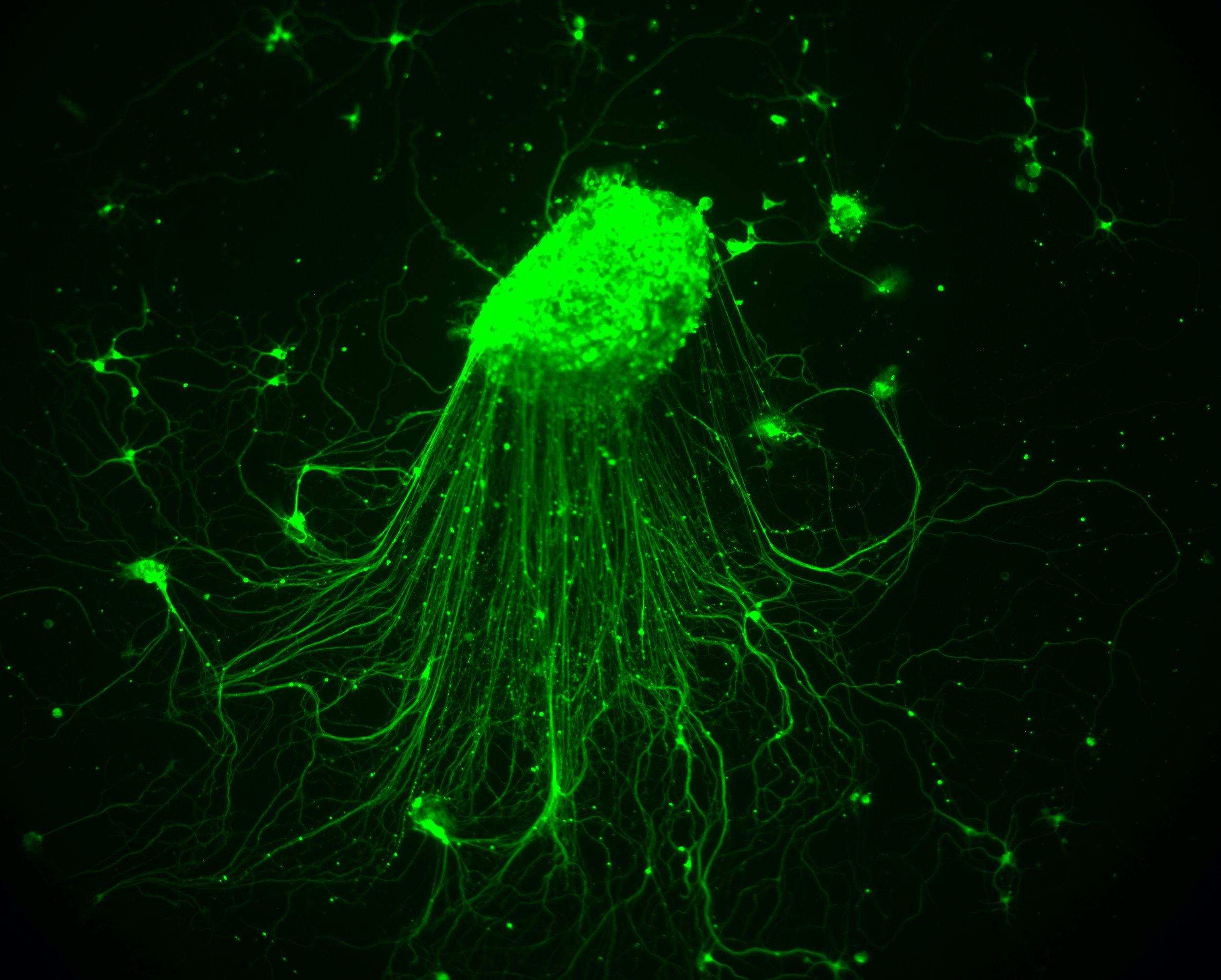 Neuron Squid (JParker).jpg