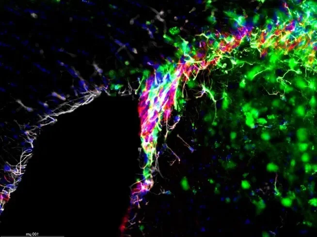 Neurogenesis and Repair 2026