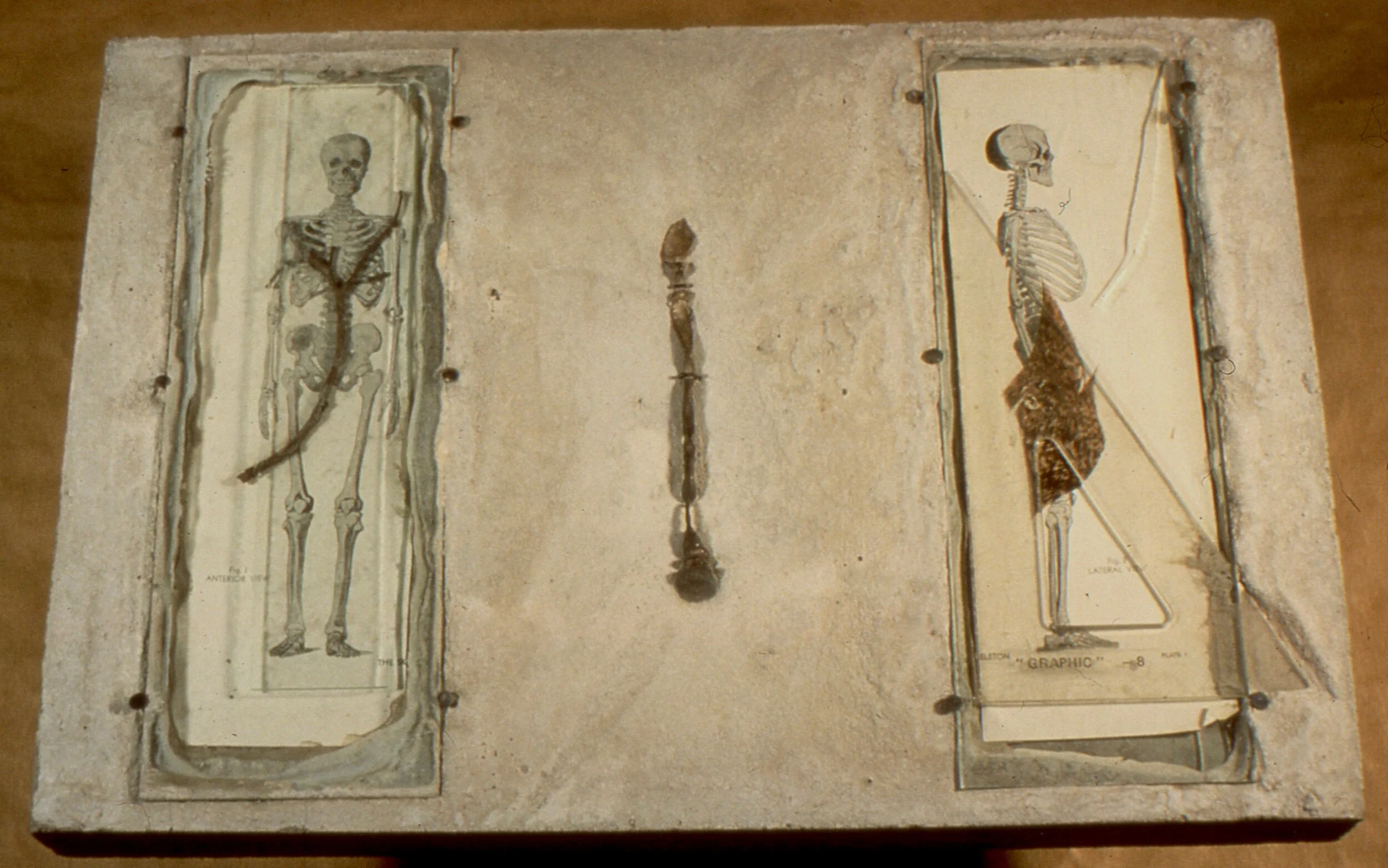 Medicine Tablet .jpg