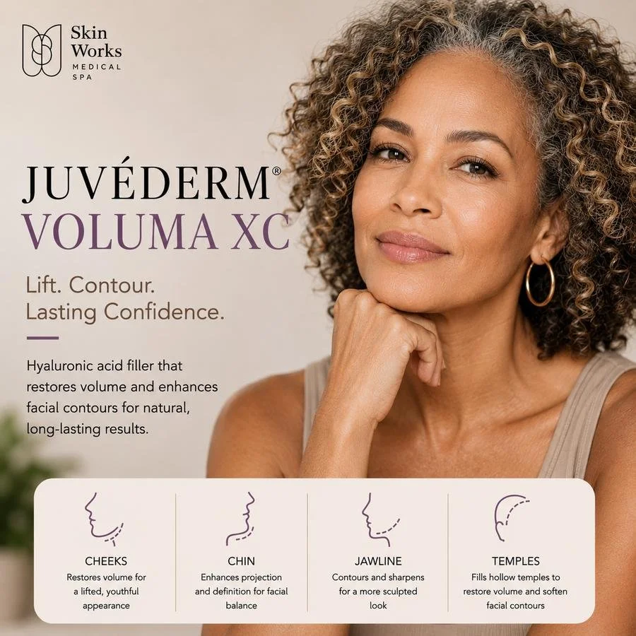 Juvederm® Voluma XC