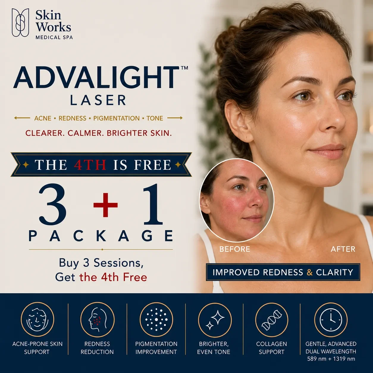ADVALIGHT_Laser_Web.webp