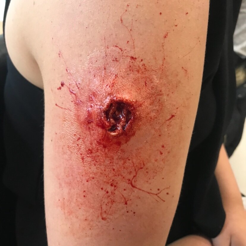 Silicone bullet wound flat mould.
(November 2019)