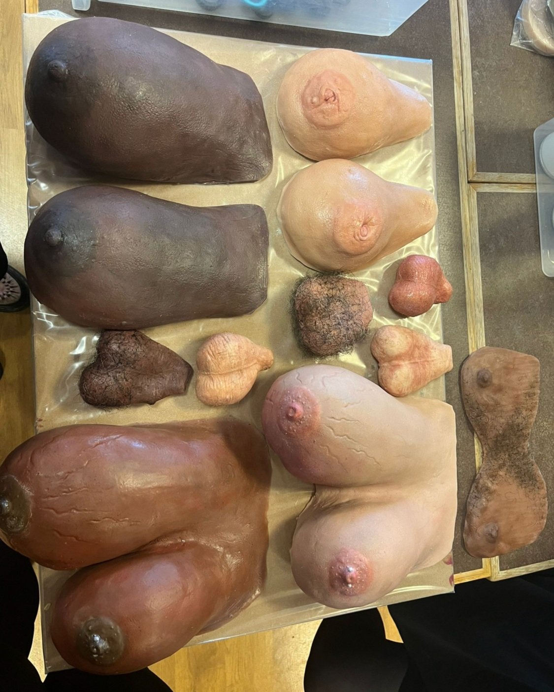 Cancerous breasts and testicles, made as educational tools for nursing students.
(September 2023)