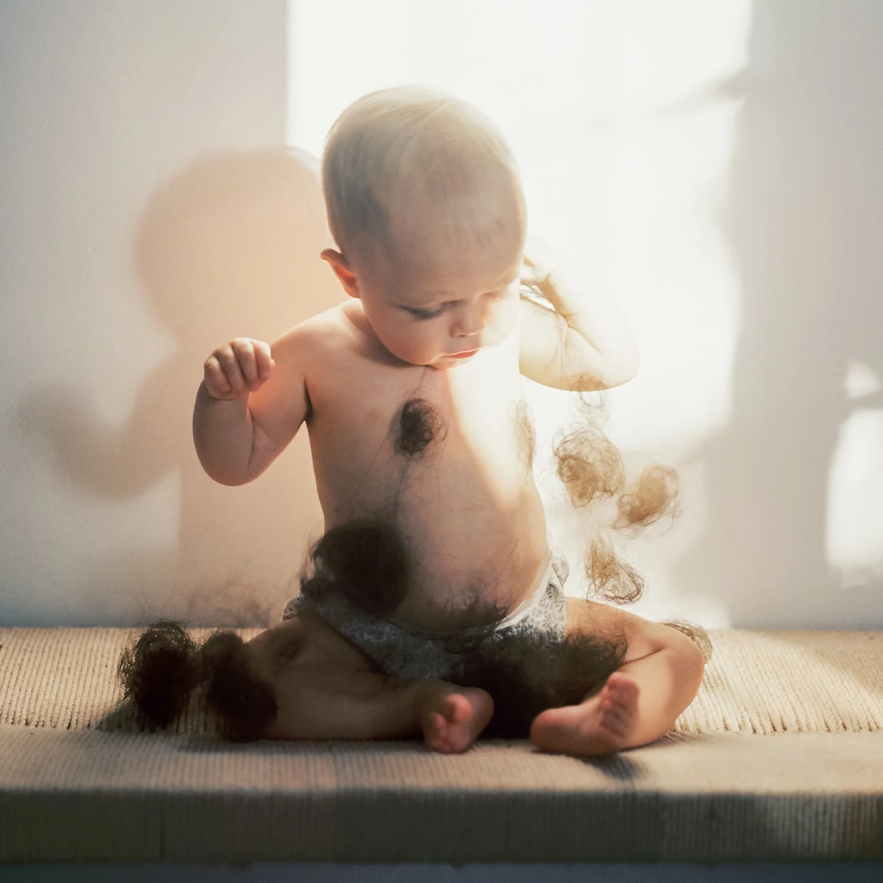 postpartum hairloss: a visual diary