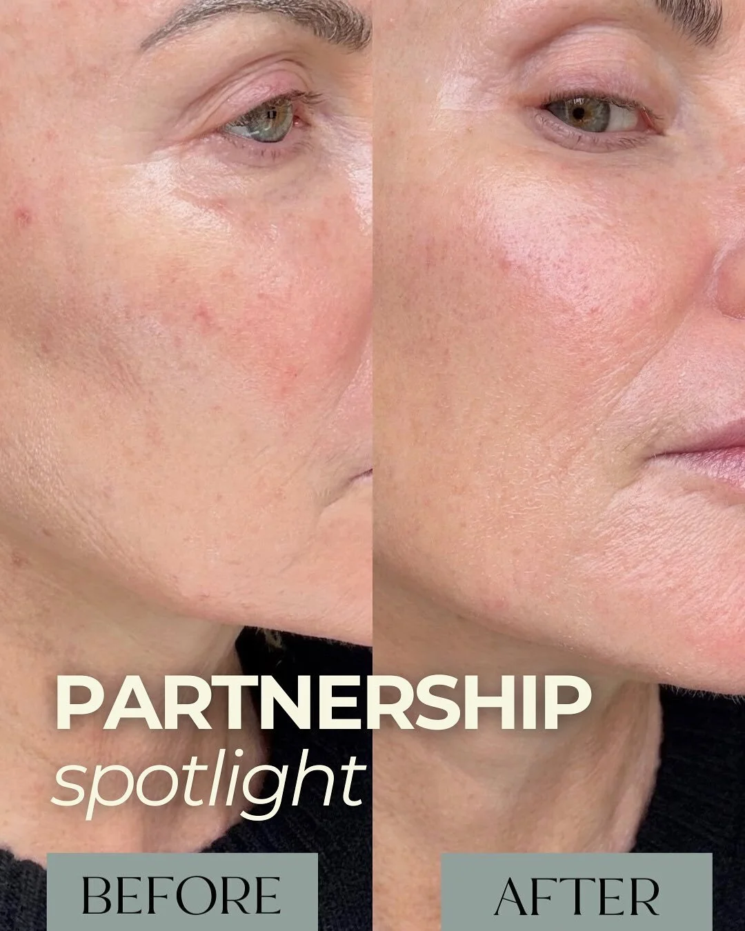 @katie_brindle x @currentbody 

Proof that effective beauty partnerships combine education, results, and tools that fit seamlessly into real routines👌