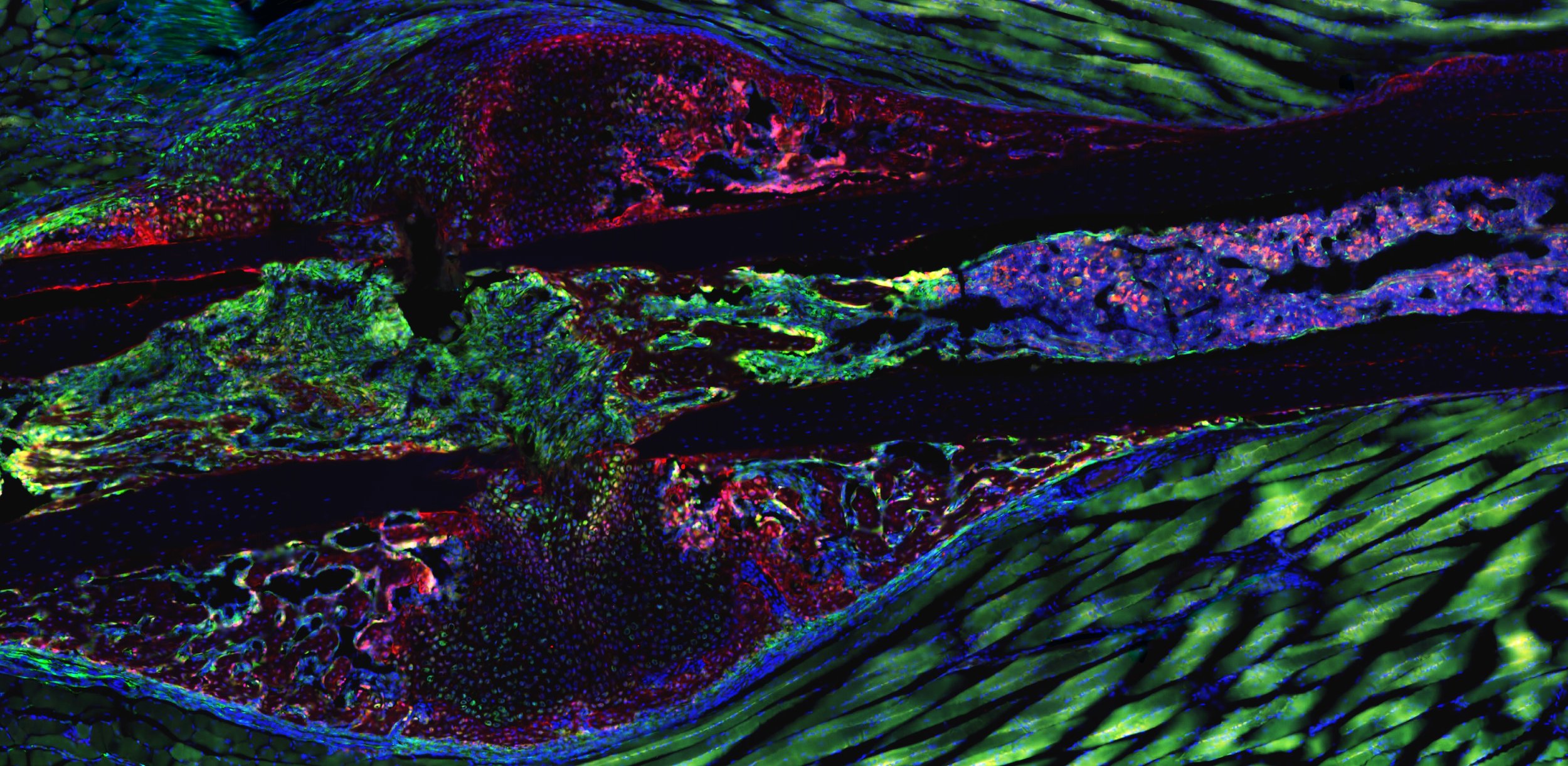 Hox11GFP expansion 10 days after ulnar fracture