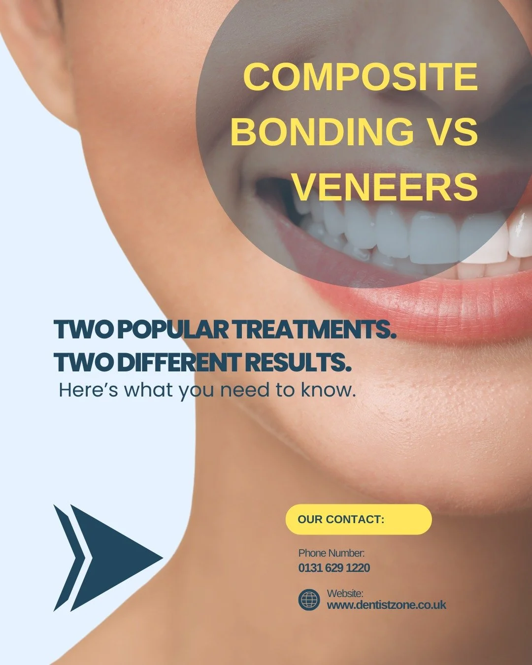 Composite bonding or veneers?
Both can transform your smile, it just depends on the results you&rsquo;re looking for.
Swipe to see the quick breakdown, then send us a message and our team will guide you towards the perfect option.
#YourDentistEdinbur