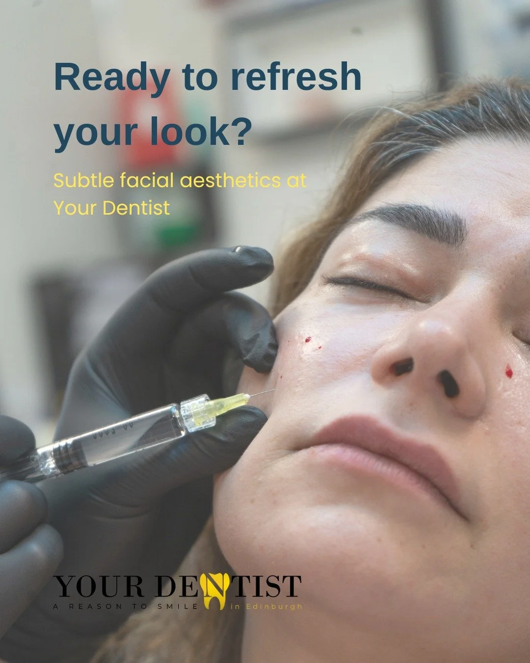 Thinking about a subtle refresh for your look?

At Your Dentist, our approach is all about natural results, treatments tailored to you, and a consultation-first approach. Every step is handled by qualified clinicians in a calm and professional settin