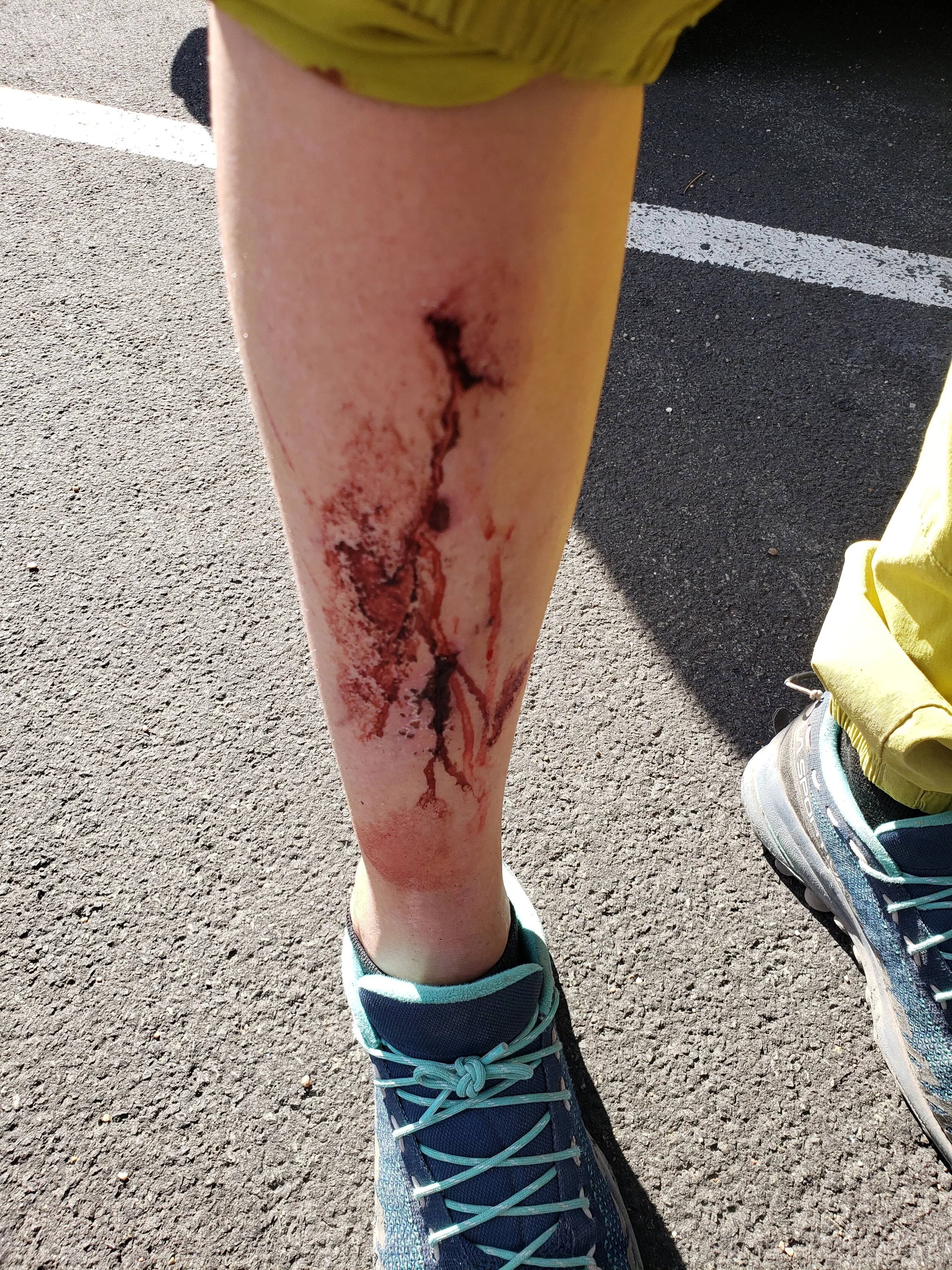 A Classic Summer Look for me...slipped on the talus again.