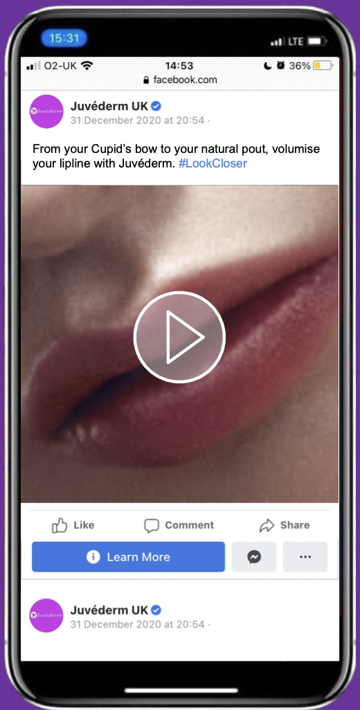 Post copy:
From your Cupid's bow to your natural pout, volumise your lipline with Juvéderm.
