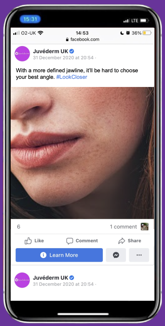 Post copy:
With a more defined jawline, it'll be hard to choose your best angle.