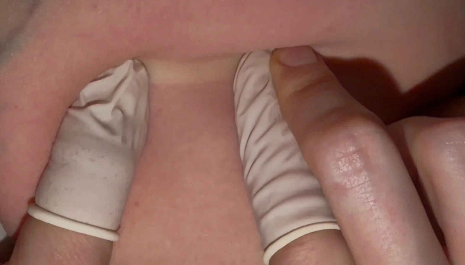 The Missing Piece in Pain and Mobility: It Might Be Your Skin
