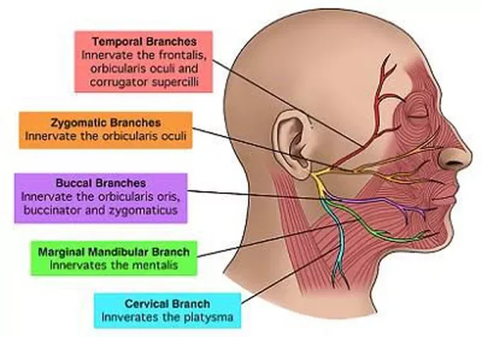 What Is Facial Nerve Palsy? Understanding Causes, Symptoms, and Recovery