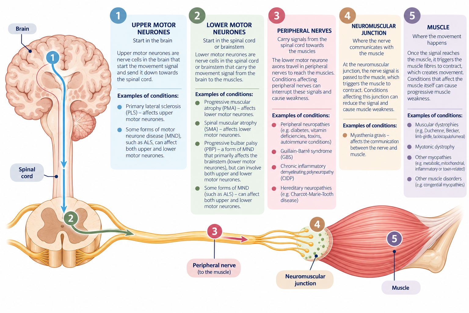MND &amp; Neuromuscular Conditions and physiotherapy 