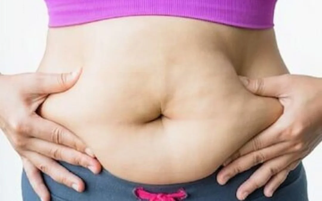 woman squeezing exposed excess belly fat
