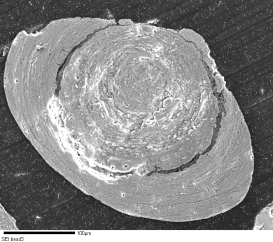 Oolitic hematite