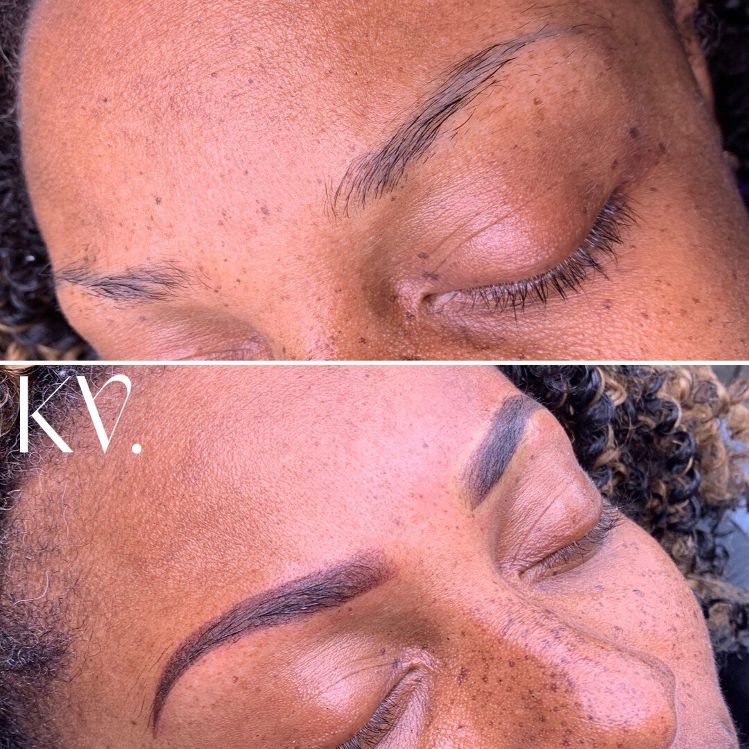 Will my brow tattoo hurt?? ⠀⠀⠀⠀⠀⠀⠀⠀⠀
⠀⠀⠀⠀⠀⠀⠀⠀⠀
A concern that a lot of people have about having their brows tattooed is, will it hurt? ⠀⠀⠀⠀⠀⠀⠀⠀⠀
⠀⠀⠀⠀⠀⠀⠀⠀⠀
Barely. Most of my clients end up dozing off to sleep. Seriously.  Although it obviously depend