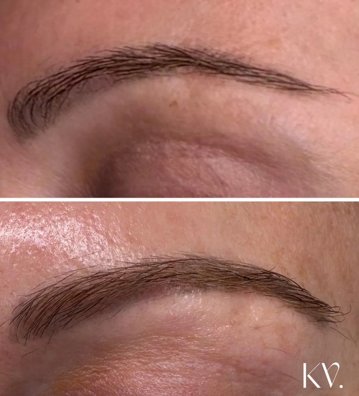 Yes this is REAL HAIR that has grown back over 4 months of treatment! 👏🏼

Have you noticed the tails of your brows slowly disappearing, annoying gaps that never used to be there and general thinning that&rsquo;s leaving you feel underwhelmed with y
