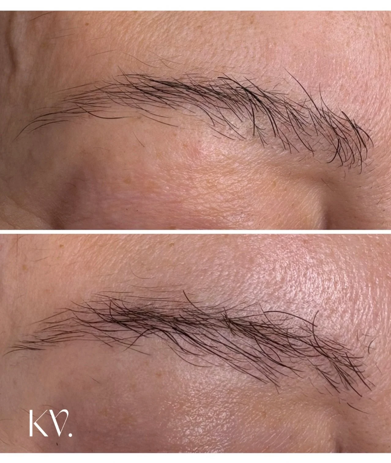 &bull; The Brow Revive Protocol &bull;

4 treatments, 4 weeks apart + daily at home Brow Revive Serum. 

A process of encouraging the hair you&rsquo;ve lost over time, to come back&hellip; 

Book online or book a consult for more information 💻