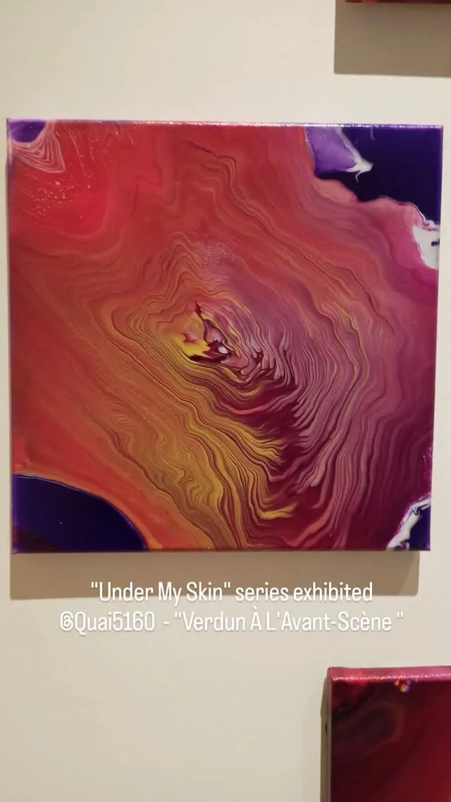 ✨ I am honored to share that 10 works from my "Under My Skin" series are currently exhibited at @quai5160_mdc_verdun, as part of Verdun À L'Avant-Scène.
This series imagines the voyage of the spirochetes—the bacteria be