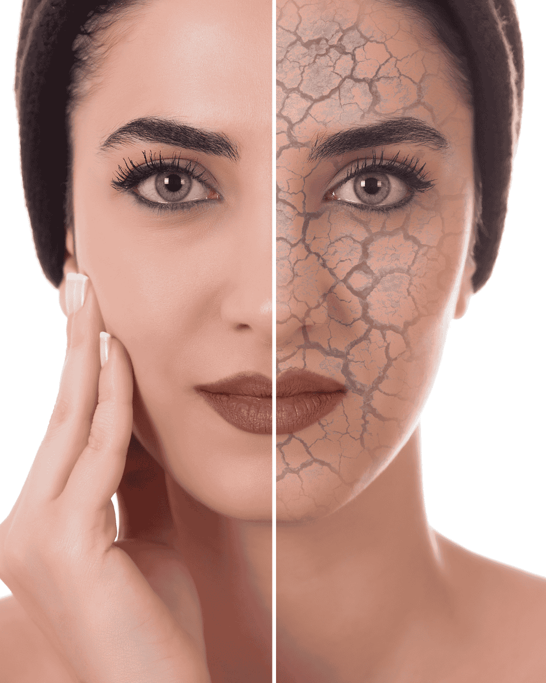 women with one half of her face with exaggerated dry skin and the other normal