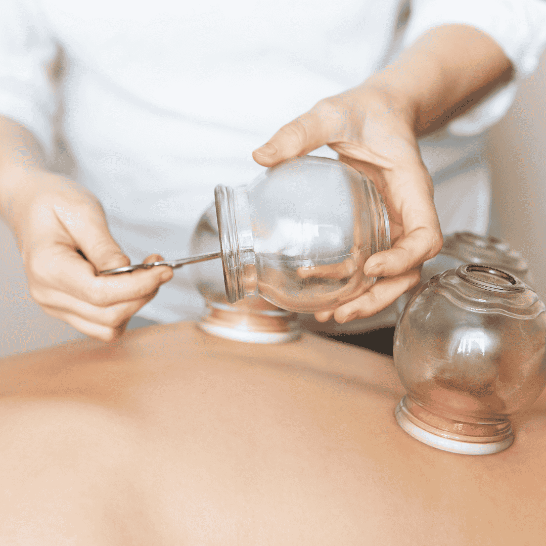 Person getting fire cupped