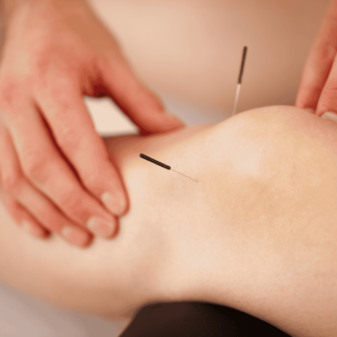 Needles in Xiyan, Knee treatment