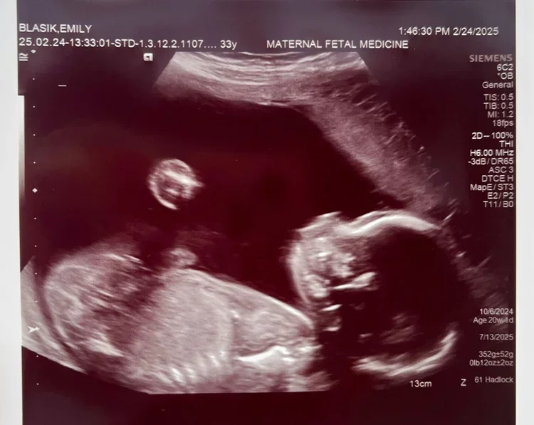 28 weeks down.