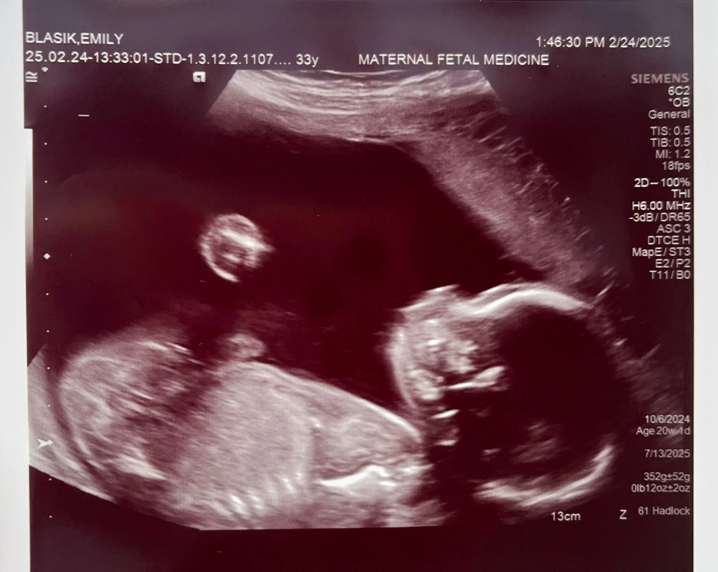 28 weeks down.