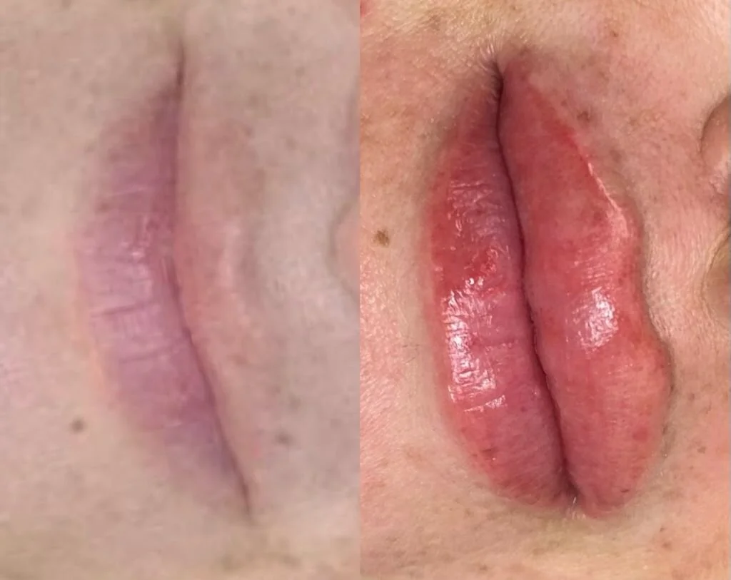 Lip Blushing