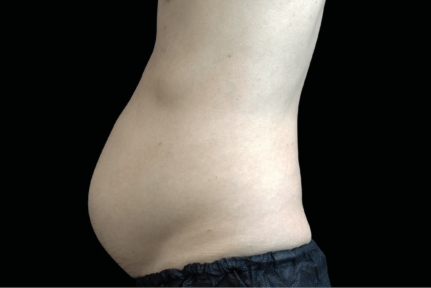 Emsculpt Neo before male abdomen 4 - WestEnd MedSpa