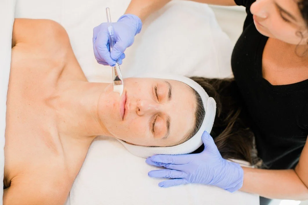 Unlock Radiant Skin with Chemical Peels at WestEnd MedSpa