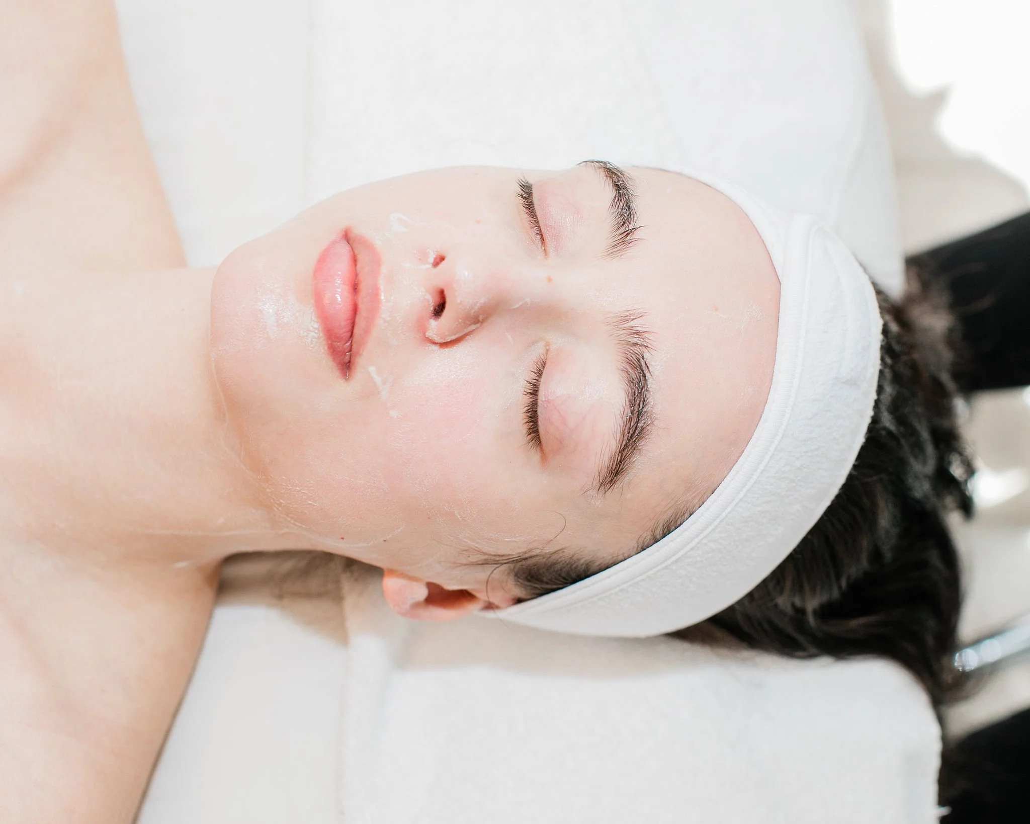 Chemical Peels: Which One Is Right for You?
