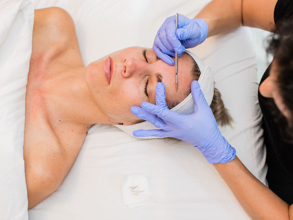 What to Put on Your Face After Dermaplaning: Skincare Routine Tips