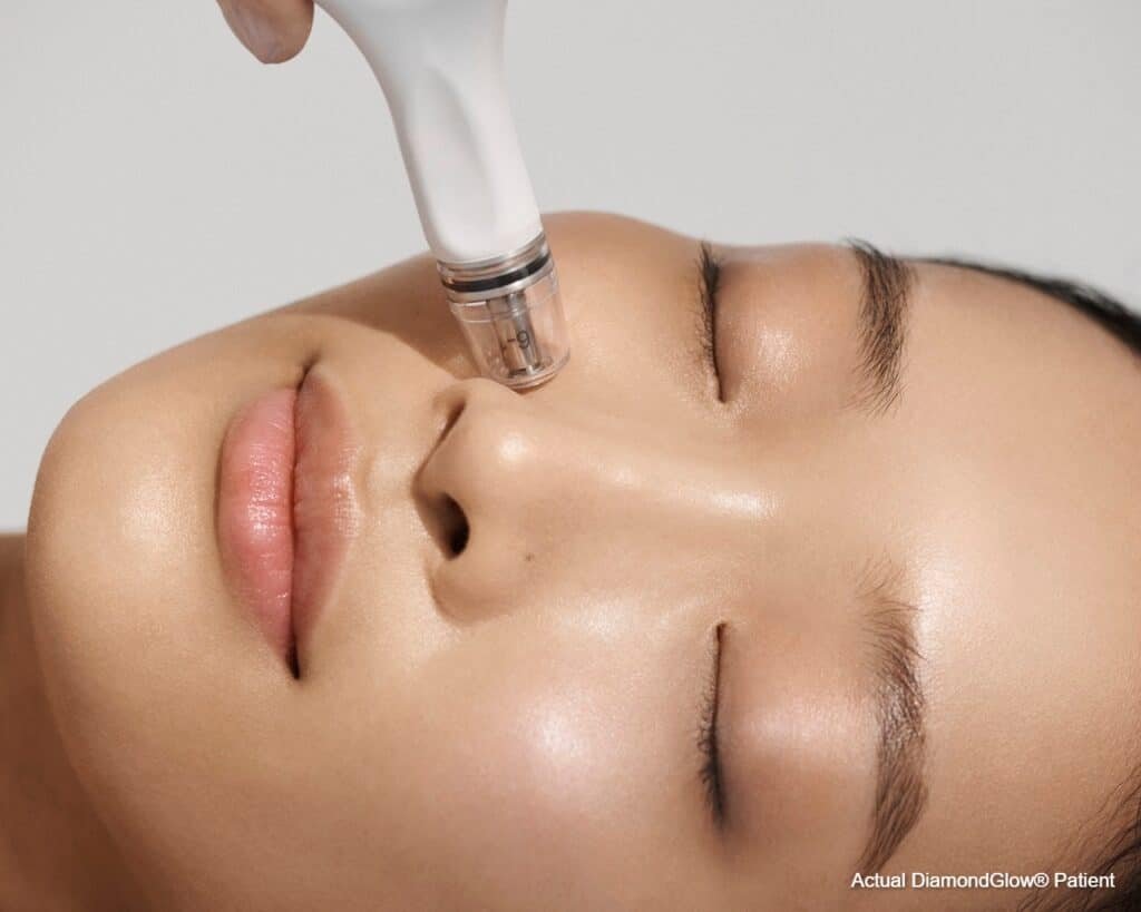 Experience Radiant Skin with the DiamondGlow® Facial at WestEnd MedSpa
