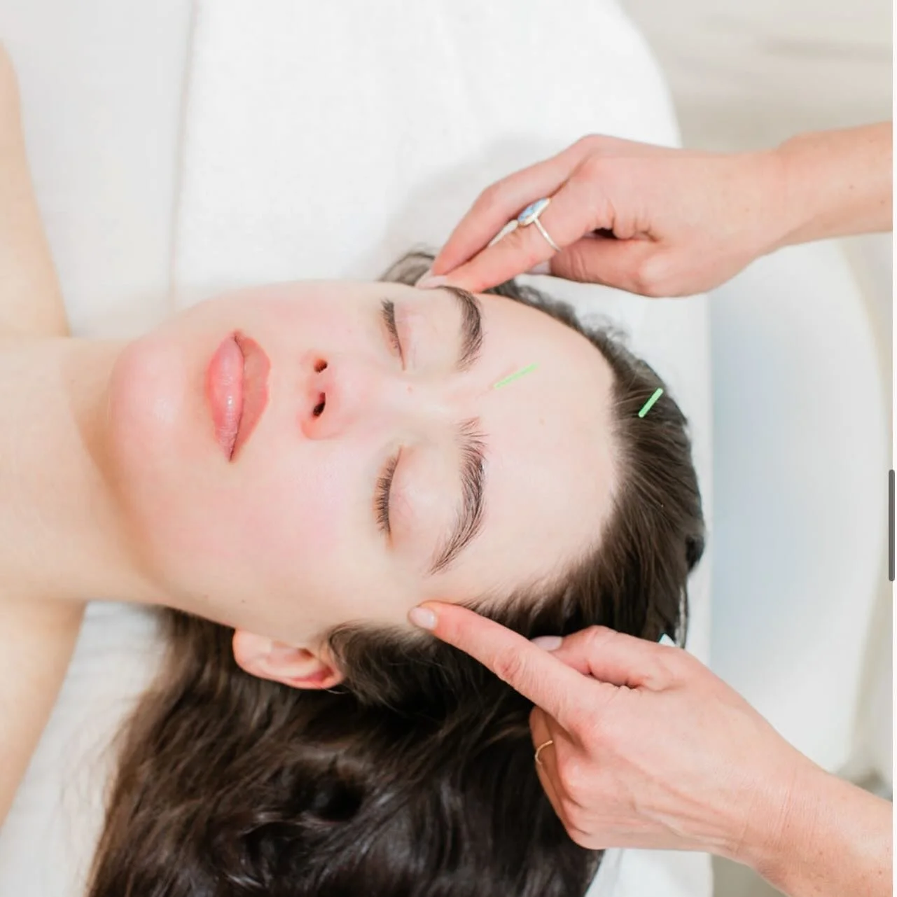 🌿 Giveaway with Shawna Todd! 🌿
We&rsquo;re gifting one lucky winner a 90-minute acupuncture session &mdash; a grounding, healing treatment that supports the mind and body.

Benefits include:
&bull; Deep relaxation
&bull; Reduced inflammation
&bull;