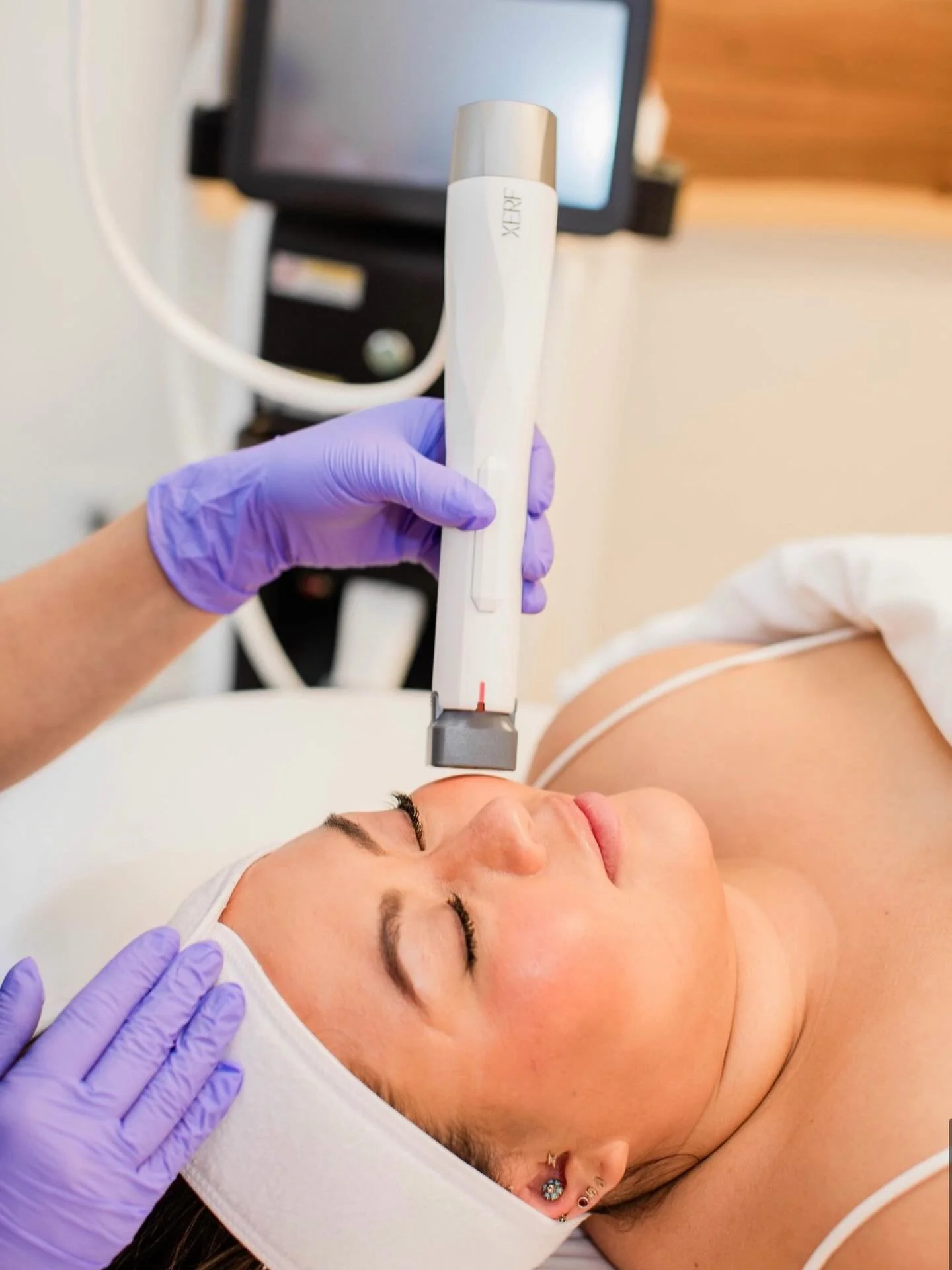 ✨ Introducing XERF at WestEnd MedSpa ✨
Exclusive to the Roaring Fork Valley

We&rsquo;re excited to bring XERF, the latest innovation in non-invasive skin rejuvenation, exclusively to WestEnd MedSpa &mdash; the only medspa in the Roaring Fork Valley 